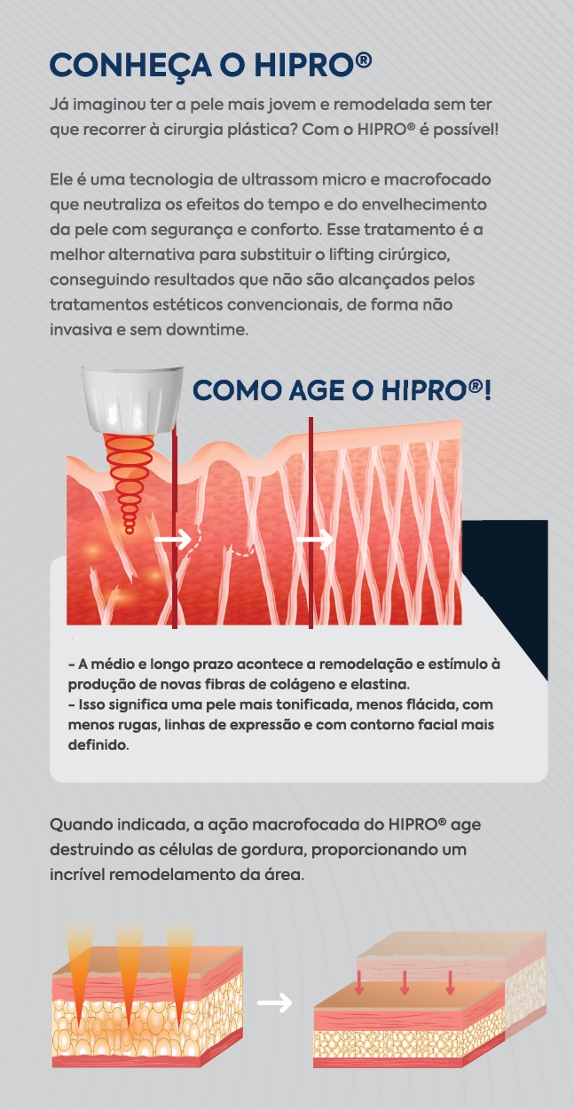 HIPRO HIFU conhe&ccedil;a